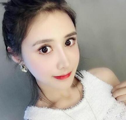 下頜角手術(shù)45天