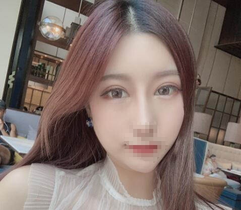 北京彤美整形醫(yī)院專家李長賦做鼻部綜合整形怎么樣？