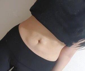 顧鵬腹部吸脂案例展示