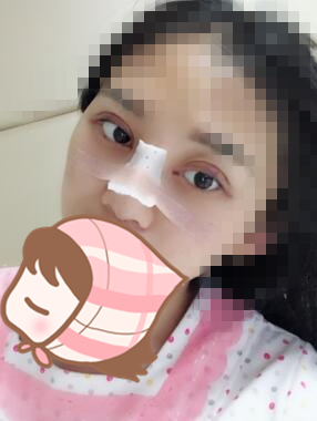 手術(shù)之后恢復效果。