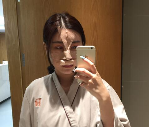 北京彤美整形醫(yī)院專家李長賦做鼻部綜合整形怎么樣？