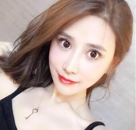 樸興植做下頜角案例效果反饋