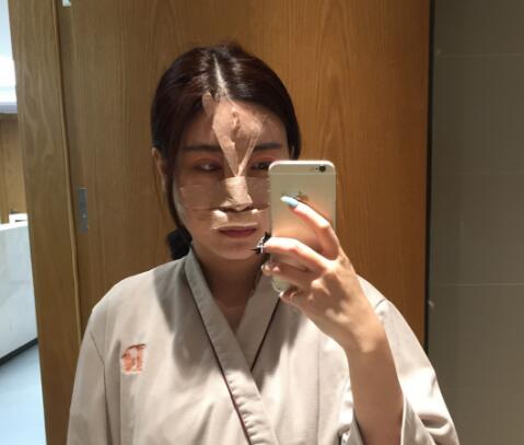 鼻綜合整形手術(shù)時(shí)