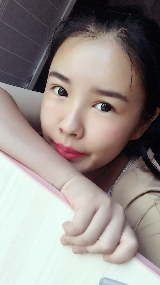 西安莎曼妃醫(yī)療美容醫(yī)院醫(yī)生樸俊做自體脂肪豐太陽穴效果怎么樣？