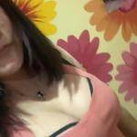 南寧伊美整形醫(yī)生凌宏量做自體脂肪隆胸怎么樣？自體脂肪隆胸案例