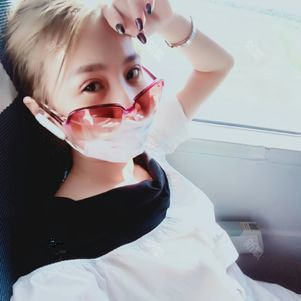 雙眼皮手術(shù)第五天