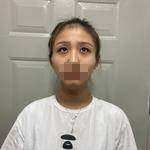 楊力醫(yī)生案例展示 楊力醫(yī)生案例展示