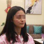 安徽立新醫(yī)學(xué)美容醫(yī)院程立新醫(yī)生面部吸脂案例效果對比圖