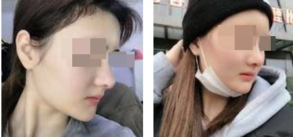 恢復(fù)過(guò)程