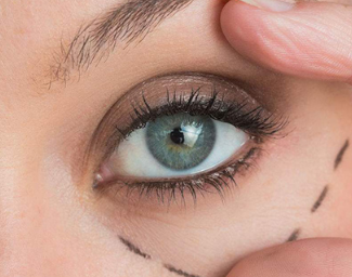 武漢涵美整形激光去黑眼圈