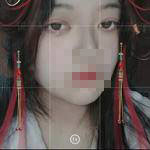 上海亞太醫(yī)療專(zhuān)家周聰做雙眼皮怎么樣？附周聰醫(yī)生雙眼皮案例