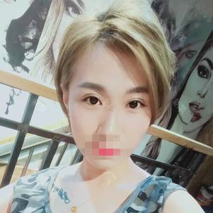 上海臻景醫(yī)療整形醫(yī)生李載成做雙眼皮怎么樣？李載成雙眼皮手術案例