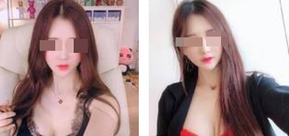 沈陽杏林整形美容醫(yī)院崔昌墉醫(yī)生做假體隆胸技術(shù)怎么樣？附案例