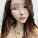 恢復(fù)過(guò)程。