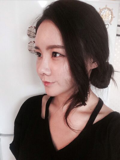 貴陽長(zhǎng)江醫(yī)院整形美容中心韓盛斌醫(yī)生做自體脂肪隆鼻+全臉填充案例