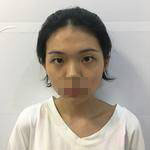 做完雙眼皮手術(shù)，不化妝也自帶美顏效果！