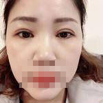 手術(shù)中的照片