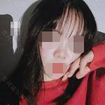 術(shù)后照片 術(shù)后照片