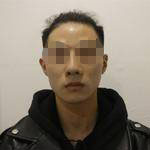 做完隆鼻失敗修復(fù)手術(shù)，再看自己儼然屬于超模中的一員了