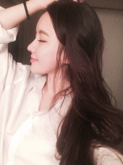 貴陽長江醫(yī)院整形美容中心韓盛斌醫(yī)生做自體脂肪隆鼻+全臉填充案例