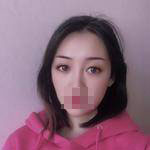 做完雙眼皮手術(shù)眼睛更加迷人了，眼睛自己會(huì)撩小哥哥