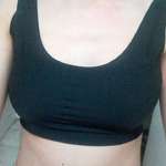 手術前的照片 手術前的照片