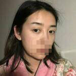 做完雙眼皮手術(shù)眼睛更加迷人了，眼睛自己會(huì)撩小哥哥