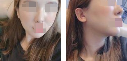 恢復過程 恢復過程