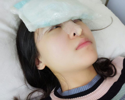 海南添美整形外科醫(yī)生王曉軍做自體軟骨隆鼻+雙眼皮+祛眼袋案例效果對比圖