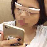 恢復(fù)中的照片