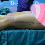 術(shù)前照片 術(shù)前照片