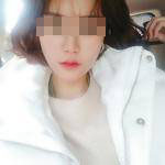 做完自體脂肪豐面頰后，我的面部比例更加完美了呢