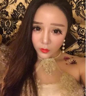 深圳南西子黃藝做自體脂肪隆胸案例效果對比圖