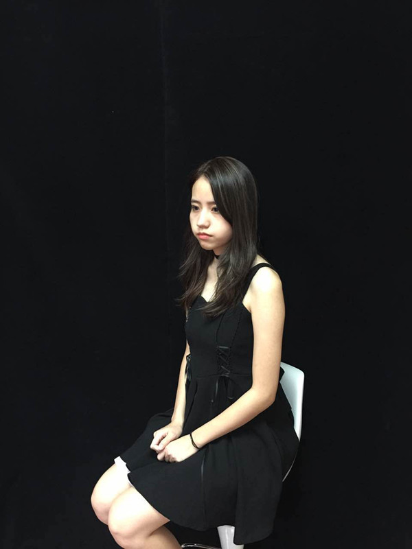 佛山曙光金子醫(yī)學(xué)整形醫(yī)生劉洲尉做埋線隆鼻技術(shù)怎么樣？附案例