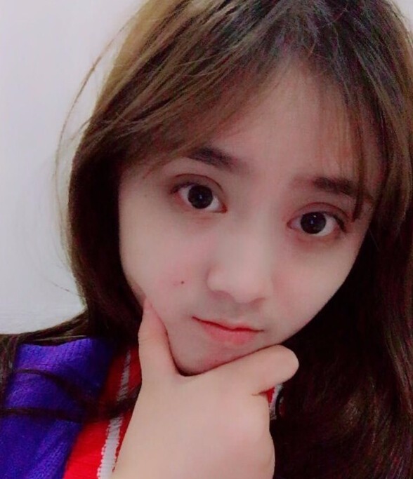 福州愛美爾整形黃林勝雙眼皮案例效果對(duì)比圖