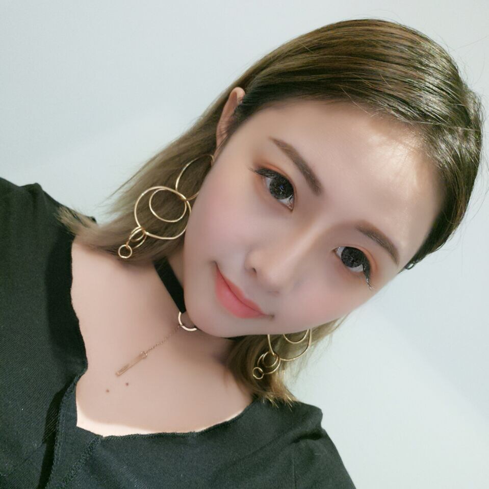 整形醫(yī)生徐長(zhǎng)亮做切開雙眼皮案例效果對(duì)比圖 整形醫(yī)生徐長(zhǎng)亮做切開雙眼皮案例效果對(duì)比圖