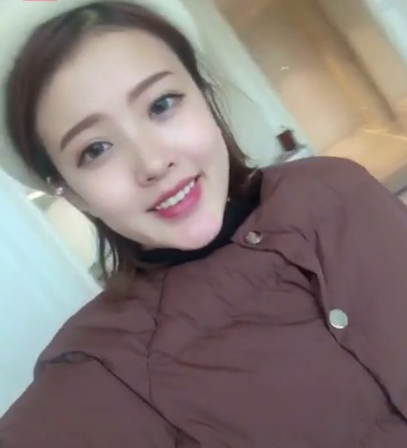 成都漢密爾頓牙齒矯正案例