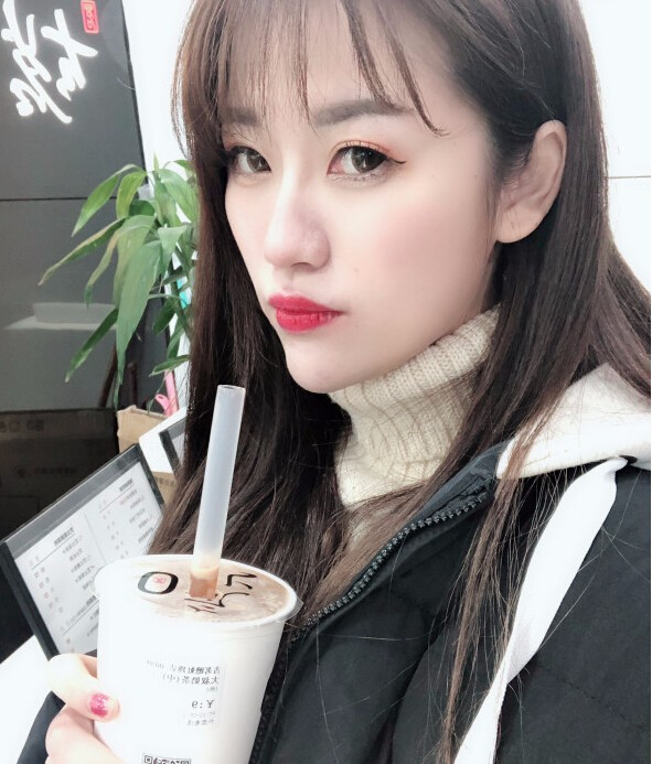 成都藝星醫(yī)療美容醫(yī)院陳遠(yuǎn)琨醫(yī)生做注射肉毒素瘦臉效果怎么樣？附案例