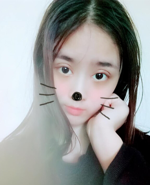 福州愛美爾整形黃林勝雙眼皮案例效果對(duì)比圖