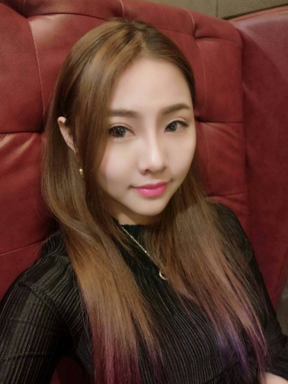 整形醫(yī)生徐長(zhǎng)亮做切開雙眼皮案例效果對(duì)比圖 整形醫(yī)生徐長(zhǎng)亮做切開雙眼皮案例效果對(duì)比圖