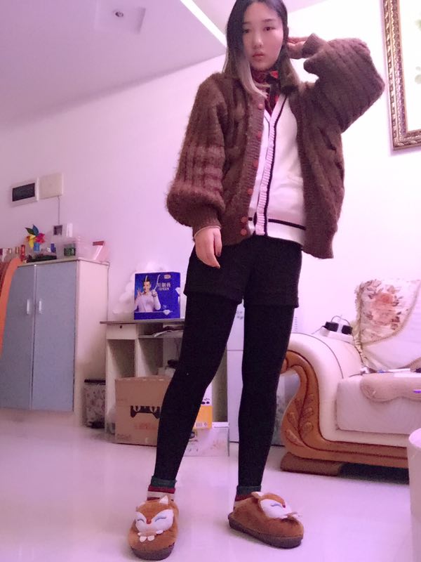 成都美立方整形醫(yī)院黃華醫(yī)生做大腿吸脂怎么樣？附大腿吸脂案例