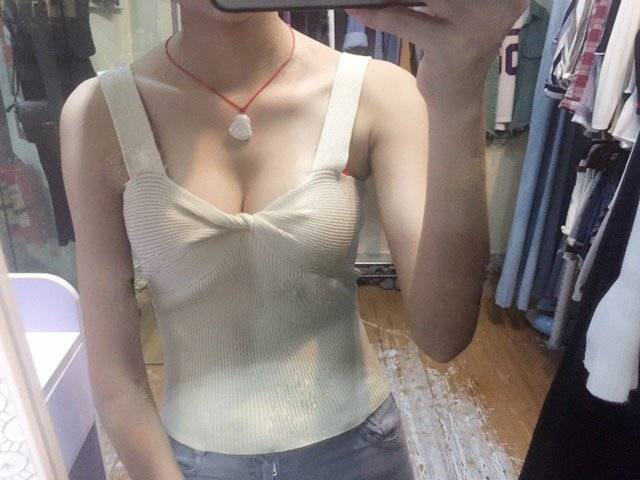 嘉興華山醫(yī)療美容醫(yī)院做假體隆胸怎么樣？嘉興華山陳榮忠假體隆胸案例