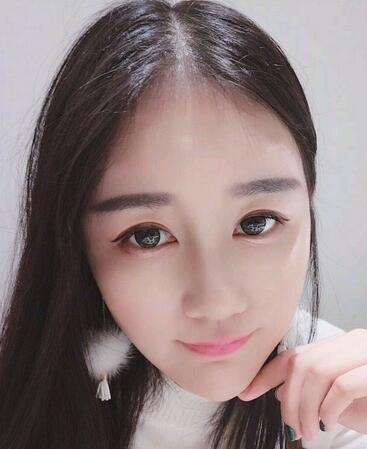 漢中韓美整形醫(yī)生常雙模假體隆鼻+耳軟骨墊鼻尖真實案例效果圖 漢中韓美整形醫(yī)生常雙模假體隆鼻+耳軟骨墊鼻尖真實案例效果圖