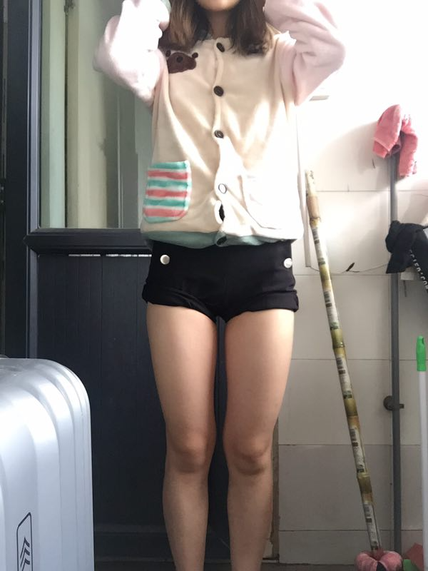 成都美立方整形醫(yī)院黃華醫(yī)生做大腿吸脂怎么樣？附大腿吸脂案例