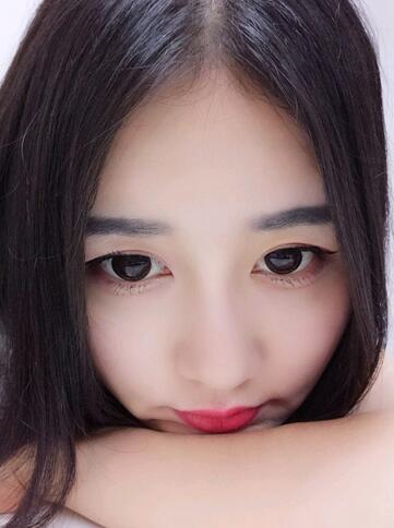 漢中韓美整形醫(yī)生常雙模假體隆鼻+耳軟骨墊鼻尖真實案例效果圖 漢中韓美整形醫(yī)生常雙模假體隆鼻+耳軟骨墊鼻尖真實案例效果圖