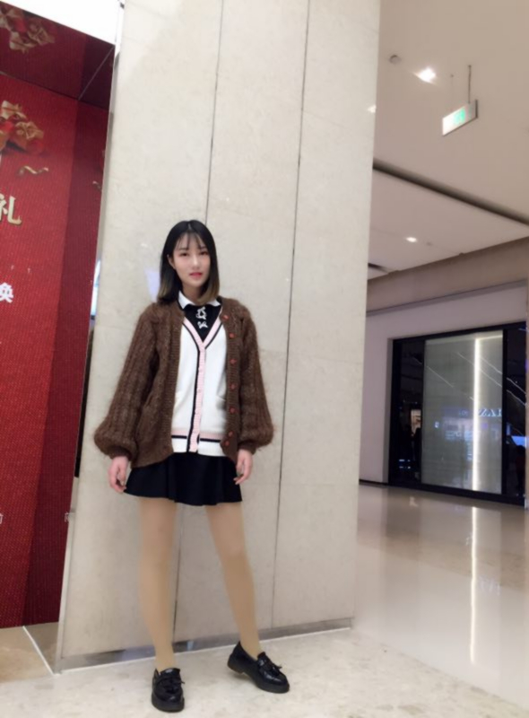 成都美立方整形醫(yī)院黃華醫(yī)生做大腿吸脂怎么樣？附大腿吸脂案例