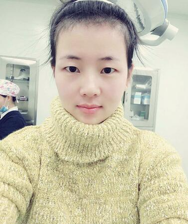 北京悅秀醫(yī)療整形醫(yī)生楊勇山做雙眼皮怎么樣？楊勇山雙眼皮案例展示