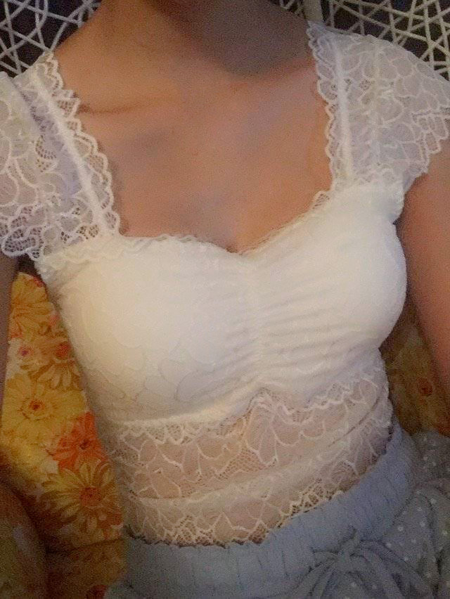 嘉興華山陳榮忠假體隆胸案例