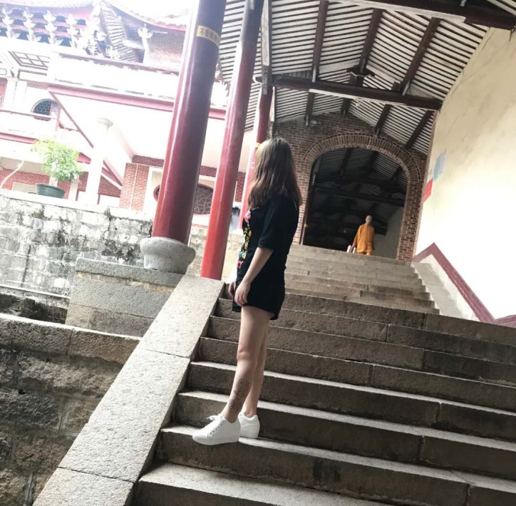 廣州軍頤醫(yī)院整形美容中心石建薇醫(yī)生腰腹吸脂真實案例對比圖