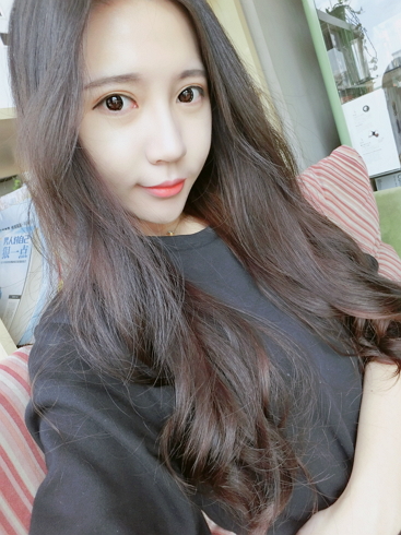  濟(jì)南安美醫(yī)療整形醫(yī)生李思思做下頜角整形怎么樣？李思思下頜角整形案例